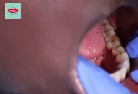 Salute dentale